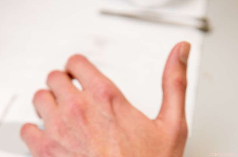 New Adhesive Patch Enables Non‑Invasive Glucose Monitoring Without Finger‑Pricks