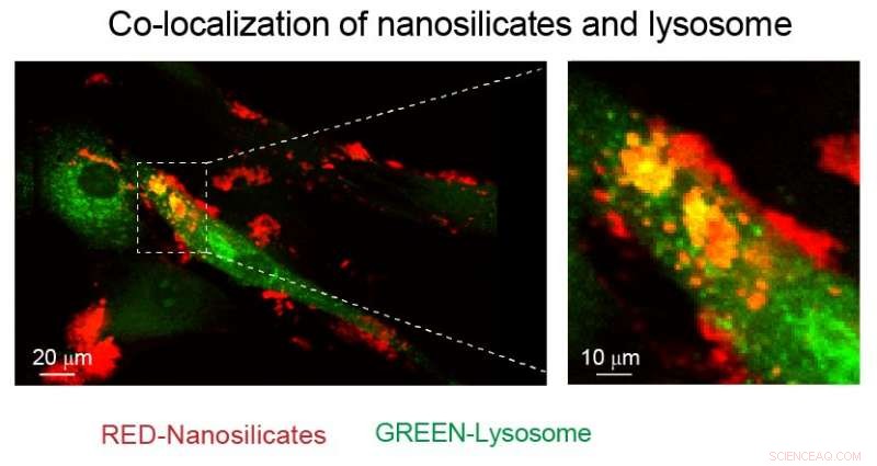 Flaxseed-Resembling Nanoparticles Enable Human Bone and Cartilage Tissue Growth