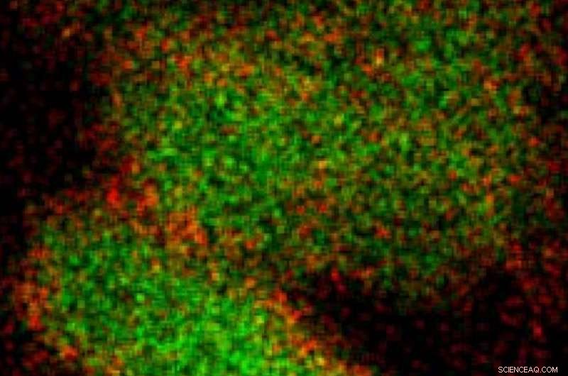 Magnesium: A Powerful Plasmonic Material for Advanced Applications