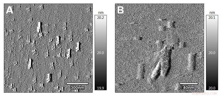 Nanoparticle Therapy Enhances Tumor Control in Mouse Models