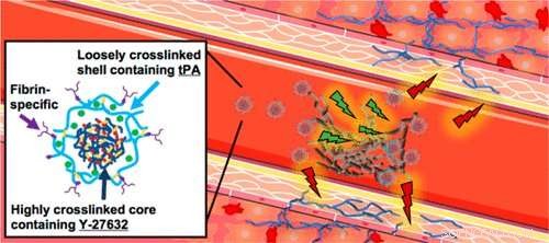 Innovative Drug Delivery System Enables Rapid, Non‑Surgical Response to Heart Attacks, Reducing Cardiac Damage