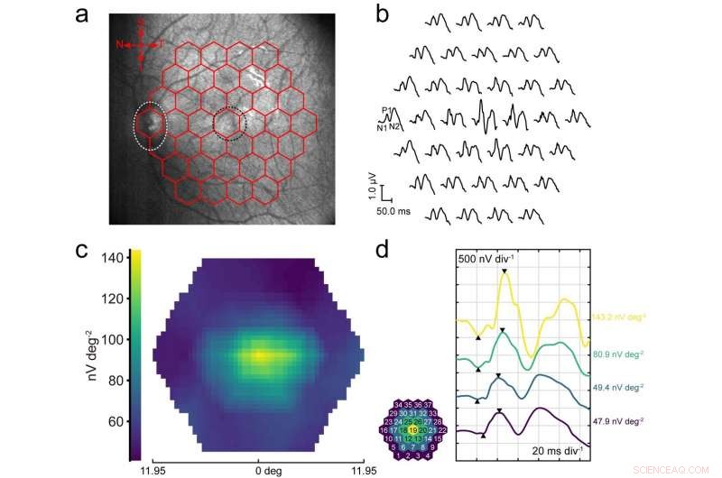 Graphene Corneal Contact Lens Delivers Robust, Irritation‑Free Topographic Electroretinography