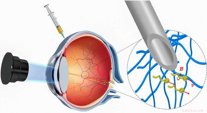 Breakthrough Nanorobots Drill Through Dense Eye Tissue with Innovative Non-Stick Coating
