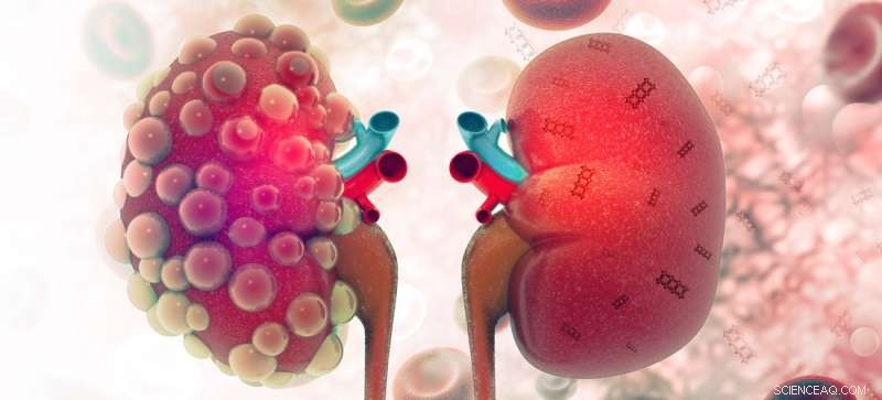Nanotechnology Breakthrough: Healing Damaged Kidneys from Acute Injury
