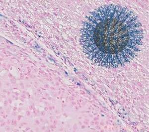 Peptide-Coated Iron Oxide Nanoparticles Revolutionize MRI for Early Cancer Detection