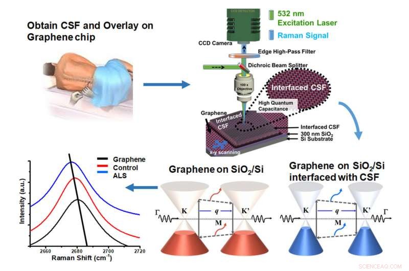 Graphene Breakthrough: Early Detection of ALS and Neurodegenerative Diseases