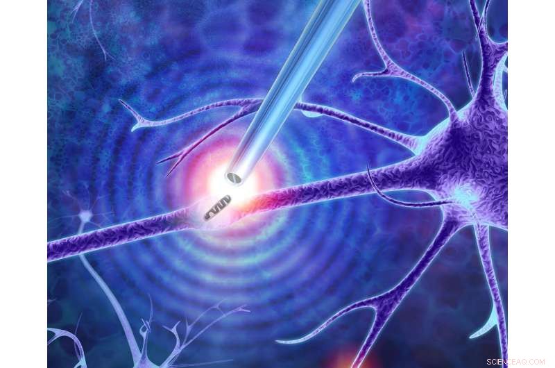 Breakthrough Nanoscale Tweezers Enable Single-Molecule Biopsies on Living Cells