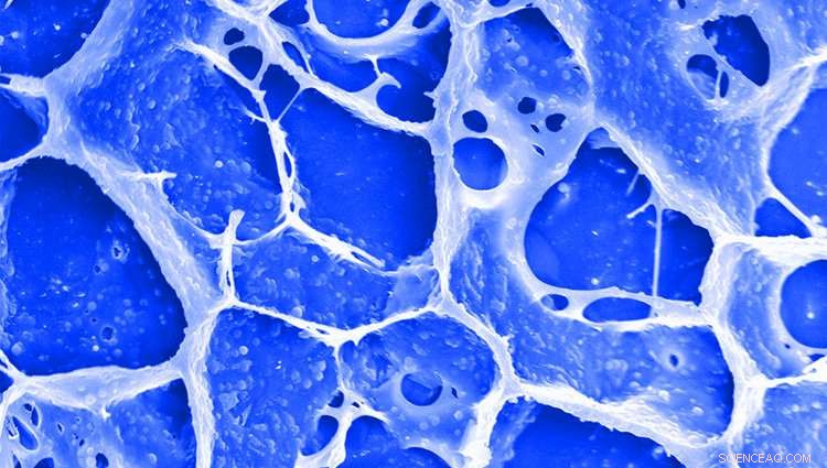 UCLA s Innovative Sprayable Gel Prevents Cancer Recurrence After Surgery