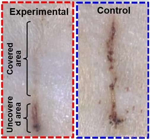 Self-Powered Electric Bandage Accelerates Wound Healing in Rats