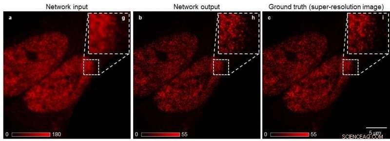 Deep Learning Democratizes Super-Resolution Nano-Scale Imaging