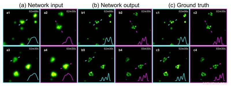 Deep Learning Democratizes Super-Resolution Nano-Scale Imaging