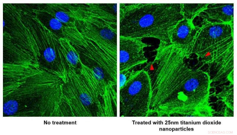 Nanoparticles Linked to Cancer Metastasis: NUS Study Reveals Blood Vessel Damage Risks