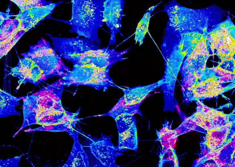 Tunneling Nanotubes Redefine Cell Biology: Institut Pasteur s Groundbreaking Structural Insights