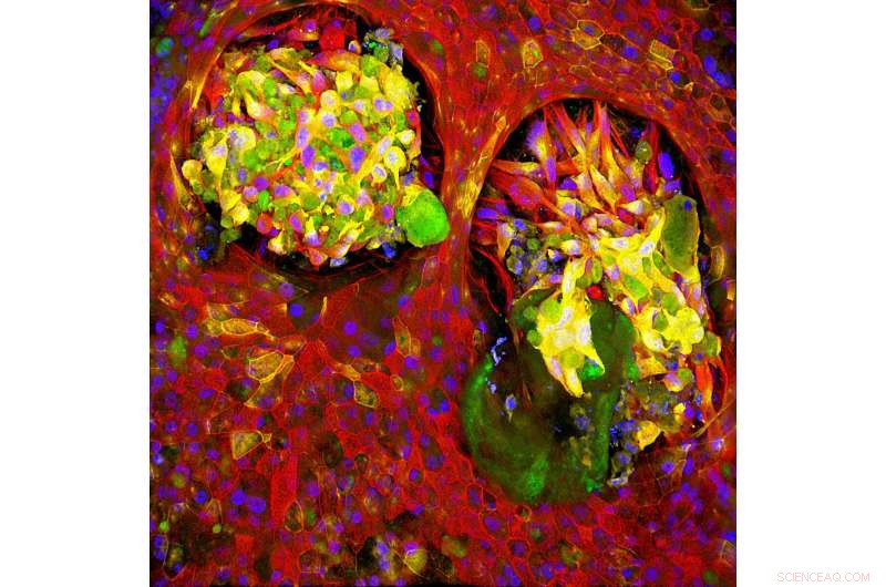 Nature-Inspired Nanoparticles: Revolutionizing Safer Cancer Drug Delivery