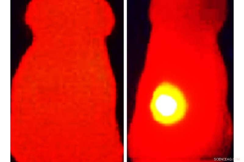 Melanin‑Coated Nanoparticles Inhibit Tumor Growth