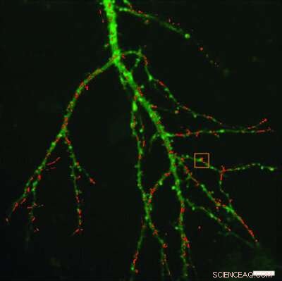 Luminescent Nanoscale Crystals Promise Deeper Insight into Body Tissues