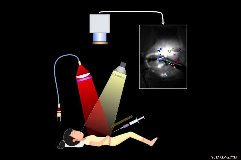 Advanced Imaging System Enhances Ovarian Tumor Resection Accuracy