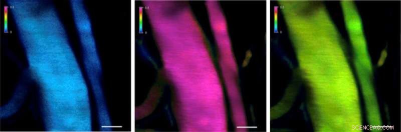 Innovative Nanomedicine Overcomes Tissue Barriers for Targeted Drug Delivery
