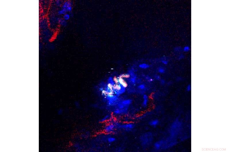 Magnetically Actuated Microrobots Enhance Targeted Nanoparticle Delivery to Tumors