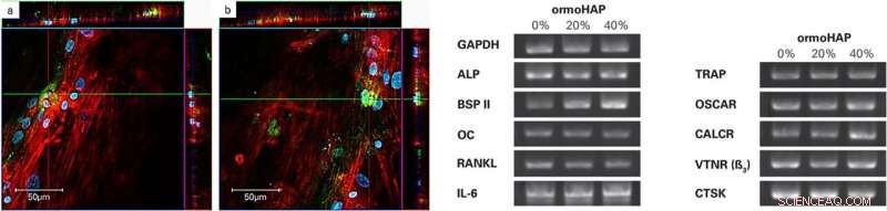 Enhancing Bone Precursor Differentiation with Organically Modified Hydroxyapatite Nanoparticles
