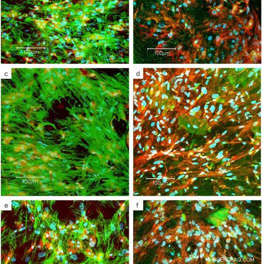 Enhancing Bone Precursor Differentiation with Organically Modified Hydroxyapatite Nanoparticles
