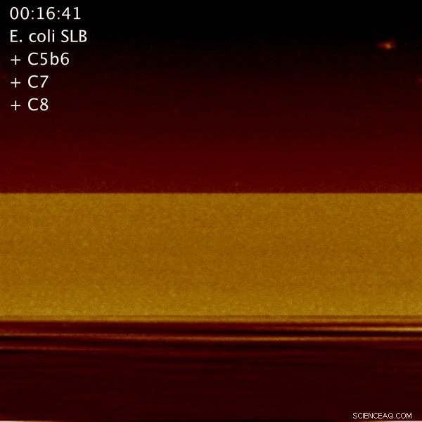 Scientists Capture Immune Nanomachines Destroying Bacteria in Real‑Time