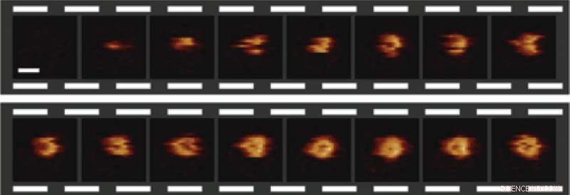 Scientists Capture Immune Nanomachines Destroying Bacteria in Real‑Time