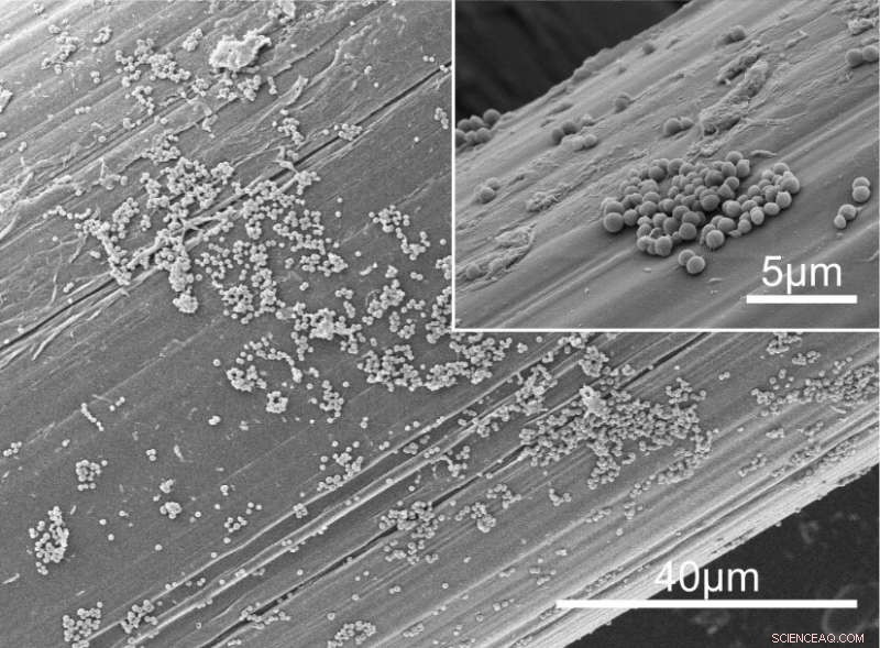 Combining Light and Nanotechnology to Eradicate Biofilms on Medical Implants