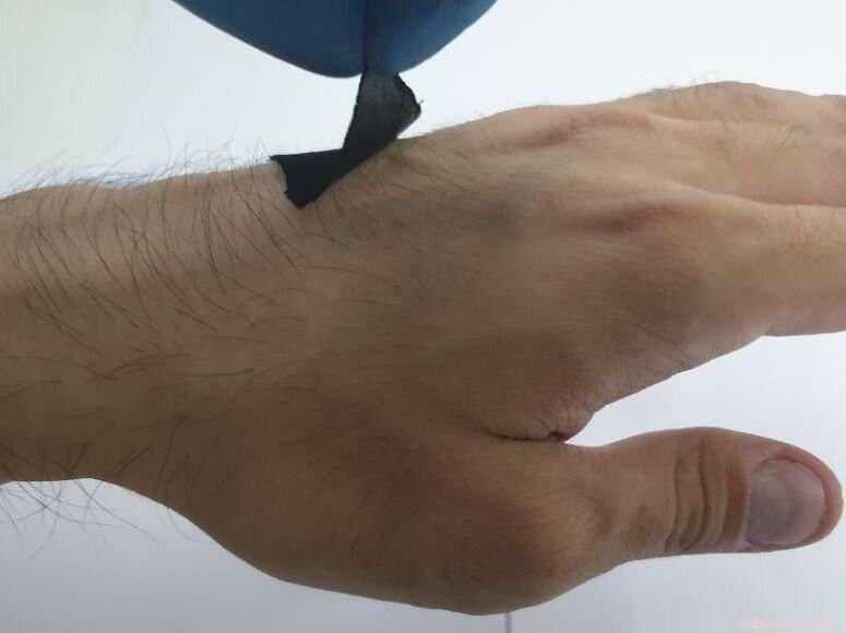 Octopus-Inspired Adhesive Graphene Sensor: Flexible, Skin‑Friendly, All‑Weather Wearable
