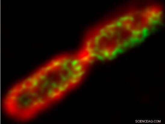 University Researchers Unveil Compound That Visualizes and Eliminates Antibiotic-Resistant Superbugs