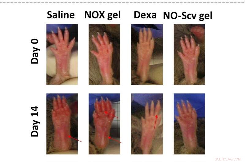 Advanced NO-Scavenging Hydrogel Offers Promising Rheumatoid Arthritis Therapy