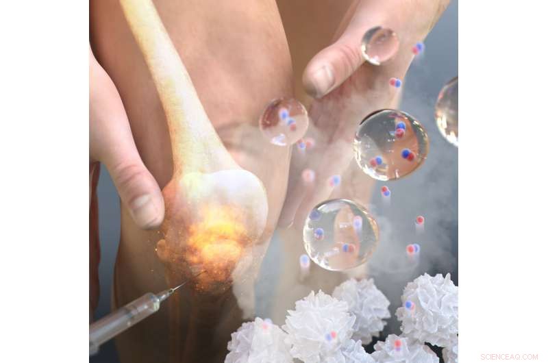 Advanced NO-Scavenging Hydrogel Offers Promising Rheumatoid Arthritis Therapy