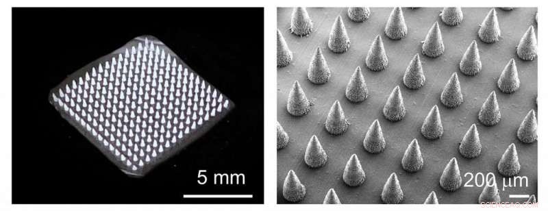 Microneedle Patch Reduces Plant DNA Extraction Time to One Minute, Accelerating Disease Detection