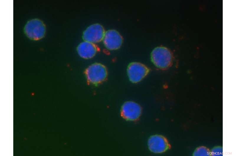 Polymer-Coated Gold Nanospheres Safeguard Human B Lymphocyte Innate Immune Function