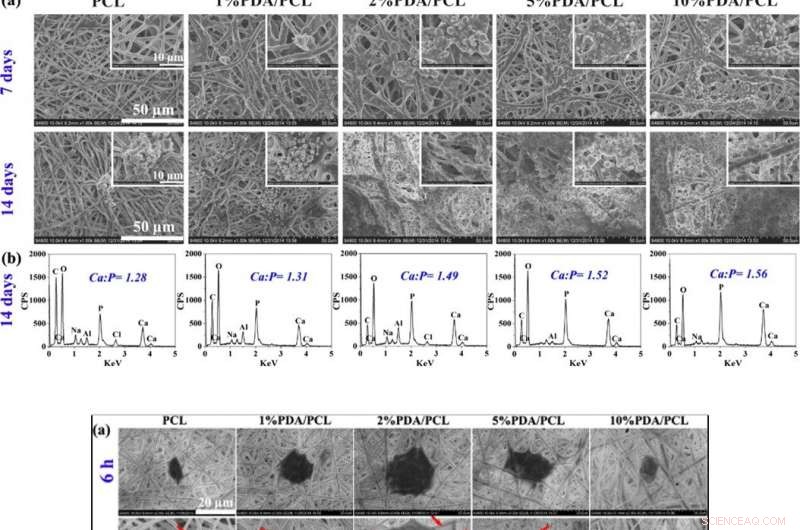 Nano-Glue Polymer Membranes: A Breakthrough for Strong Bone Regeneration
