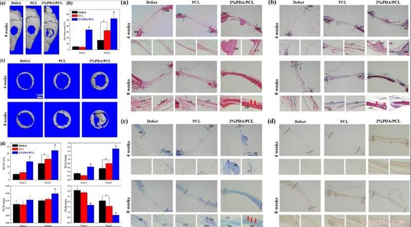 Nano-Glue Polymer Membranes: A Breakthrough for Strong Bone Regeneration