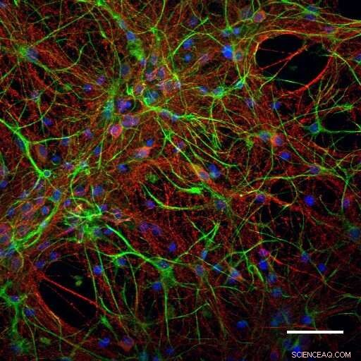 Stable, Interconnected Carbon Nanotubes Offer Efficient Platforms for Neuronal Growth
