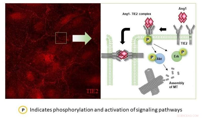 Angiopoietin-1: A Key Regulator of Endothelial Barrier Function
