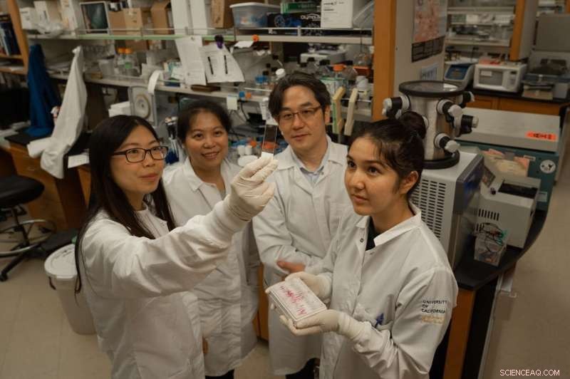 UCLA Nanocapsule Breaks Blood‑Brain Barrier to Treat Metastatic Cancer in Mice