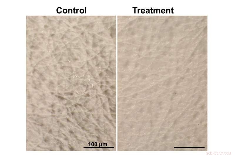 Exosome Therapy Promises Advanced Repair for Sun‑Damaged, Aging Skin
