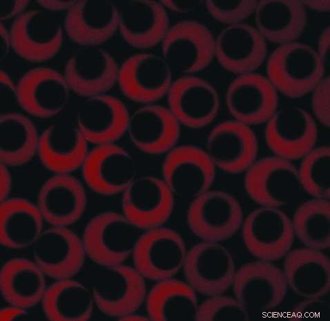 Asymmetric Microcapsules Release Drugs at Reduced Osmotic Pressures for Safer Delivery