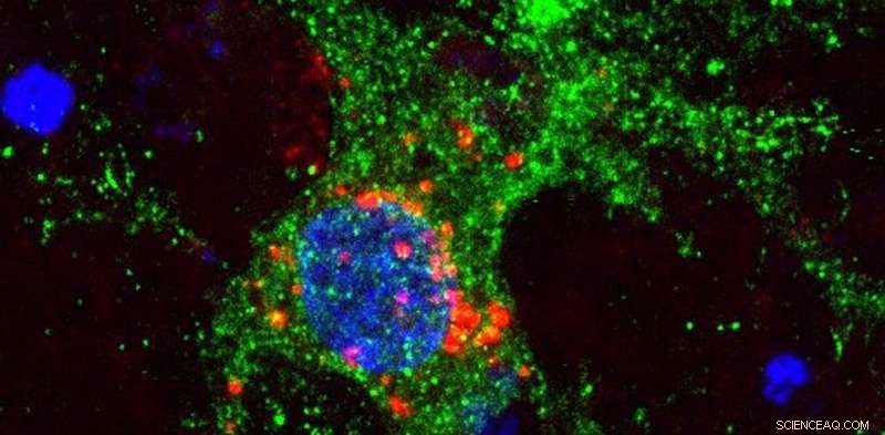 Quantum Dots Illuminating TVs Offer New Pathways in Brain Research