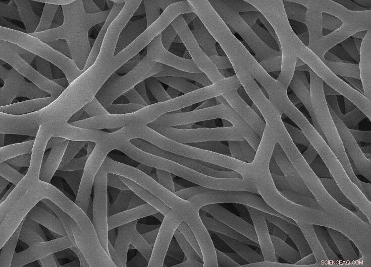 Innovative Scaffold Releases IQ‑1 to Modulate Immune Response in Regenerative Medicine