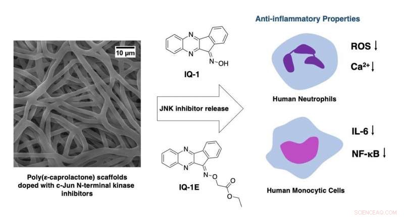 Innovative Scaffold Releases IQ‑1 to Modulate Immune Response in Regenerative Medicine