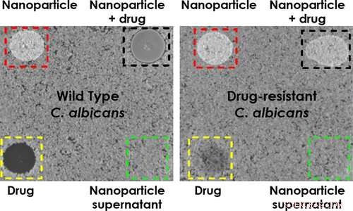 Nanoparticle Breakthrough Offers Targeted Approach Against Lethal Fungi