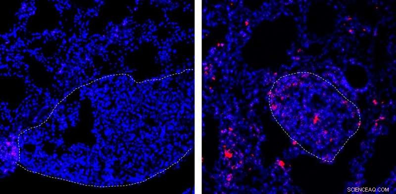Optimizing Nanoparticle Carriers for Targeted Chemotherapy Delivery