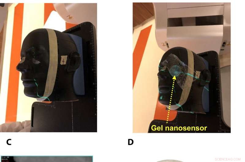 Mapping Radiation Dose Distributions with Gel-Based Nanosensors for Precise Topographical Analysis