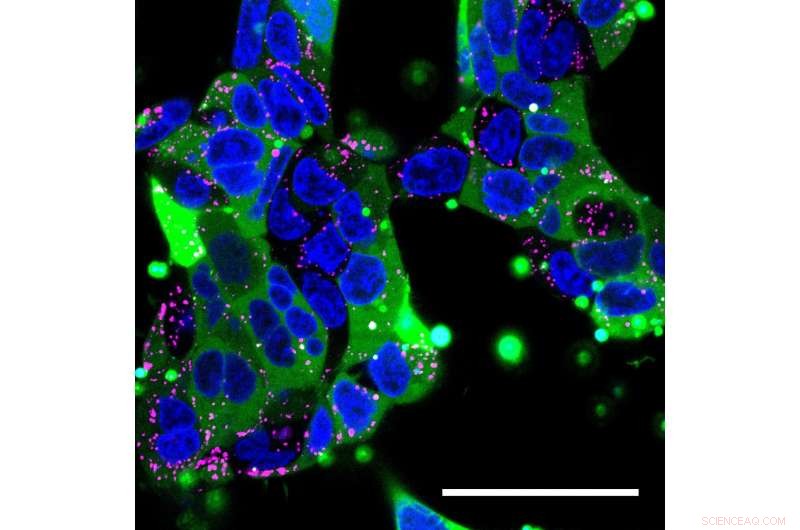 Nanoparticles Deliver Large Gene Therapies and Drugs Directly into Cells