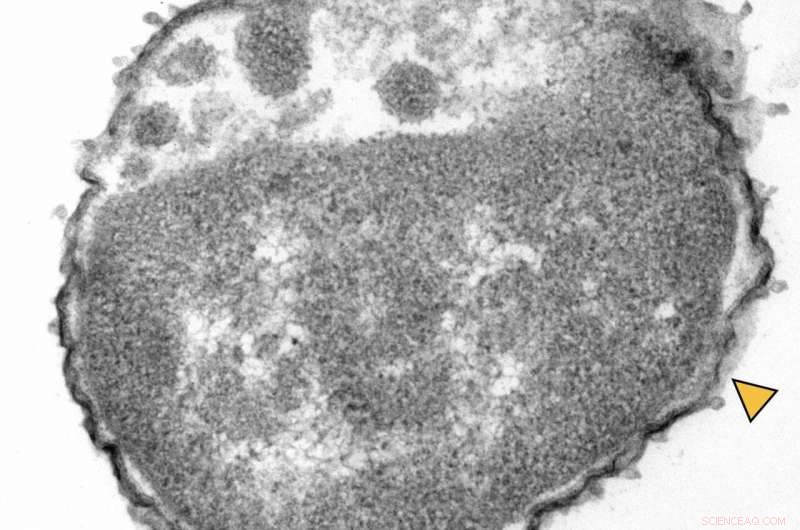 Light-Activated Nanomachines Target and Destroy Antibiotic-Resistant Superbugs