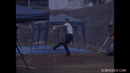 Advanced Elastic Kirigami Patch Enables Precise sEMG Analysis of Palm Muscles in Baseball Pitchers